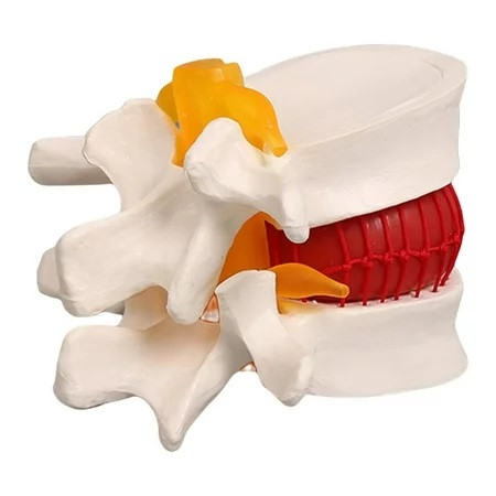 Human Lumbar Disc Model