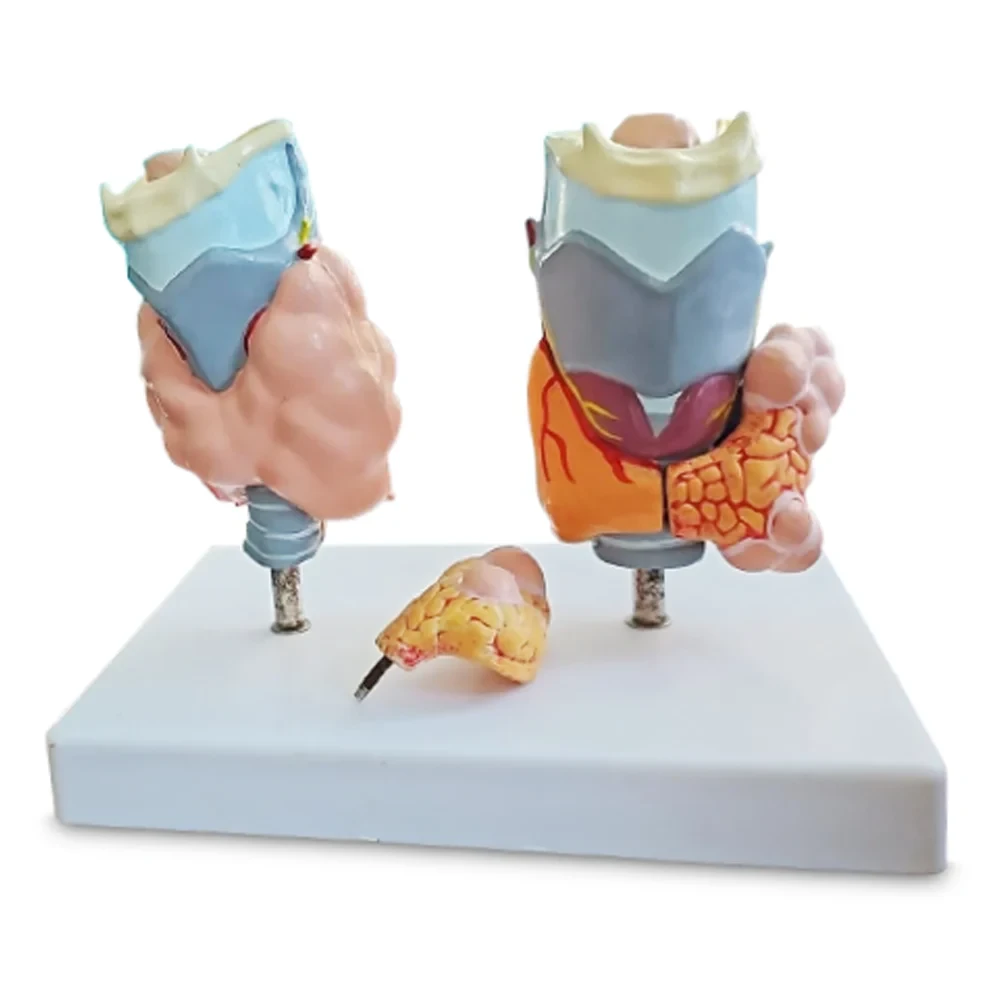 Model of Thyroid Diseases