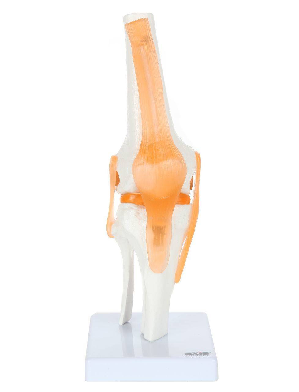Human Knee Joint Model with Ligaments
