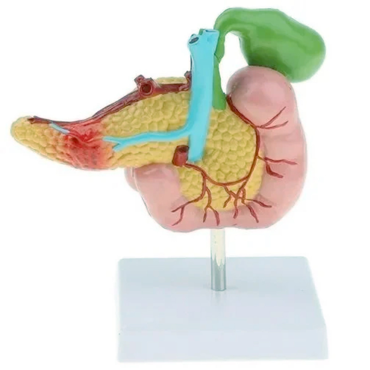 Human Pancreas Spleen Duodenum Gallbladder Pathological  Model